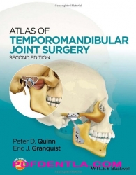 Atlas of Temporomandibular Joint Surgery, Second edition (pdf)